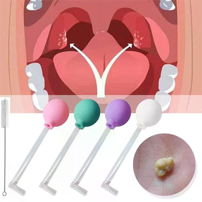 Stone Remover Tool Manual Styl - огляд і ціна Ear Wax Remover