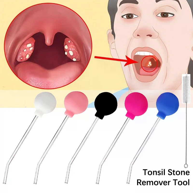 Stone Remover Tool Manual Styl - огляд і ціна Ear Wax Remover